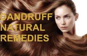 DANDRUFF/ BEST NATURAL REMEDIES