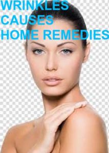 WRINKLES/CAUSES/HOME REMEDIES